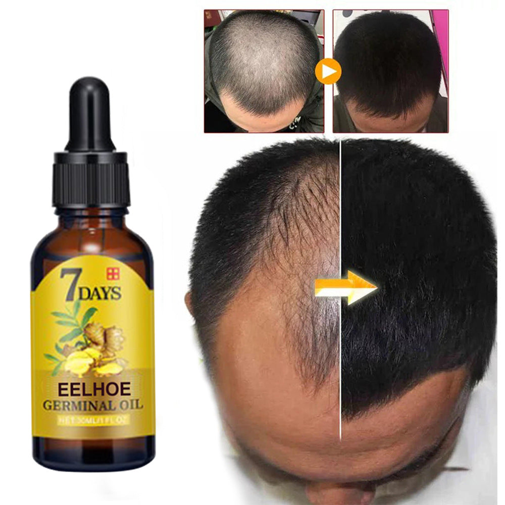 EELHOE Ginger Hair Growth Liquid Hair Nourishing And Hair Care Improving Hair Care Moisturizing And Anti-dropping Nutrient Liquid