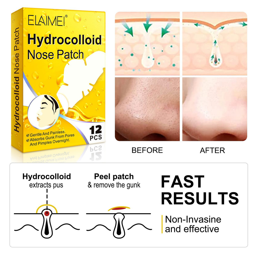 ELAIMEI Hydrocolloid Blackhead Acne Removing Nose Paste Pore Cleansing White Head Nose Mask Mild And Does Not Hurt Skin 12pcs