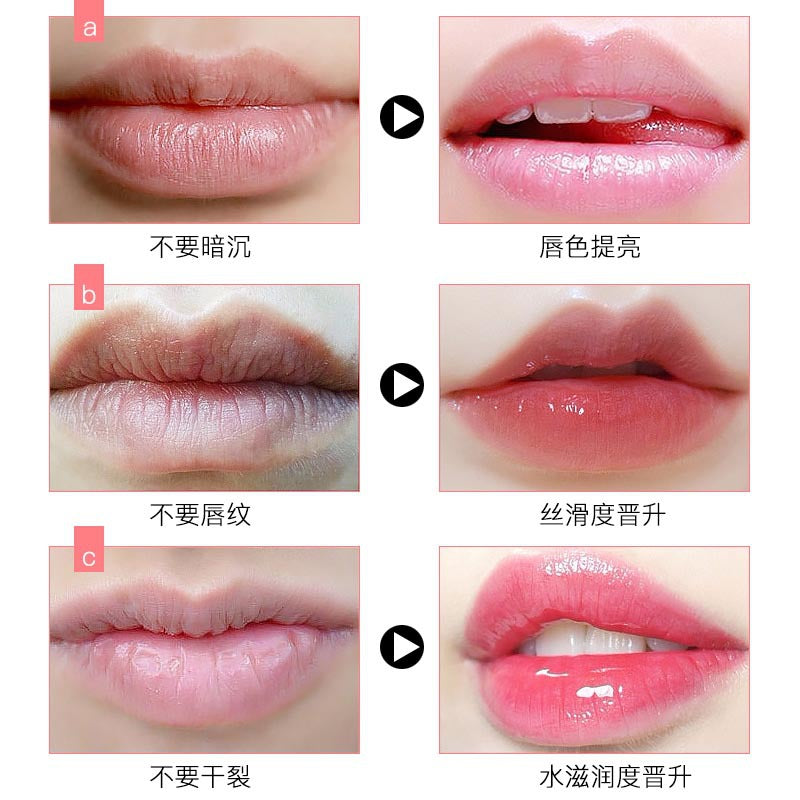 Laimei Sleep Lip Film 20g Desalination Lip Pattern Hydrating To Remove Dead Skin To Prevent Dry And Cracked Moisturizing Lip Film
